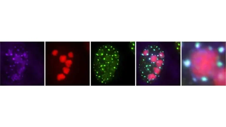 Nuclear Speckles Drive HSV-1 Infection by Boosting Viral mRNA Processing